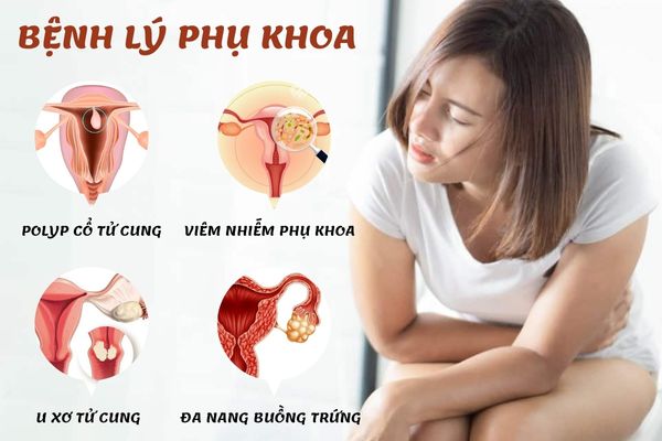 Các bệnh lý phụ khoa gây ra 1 tháng bị 2 lần kinh nguyệt