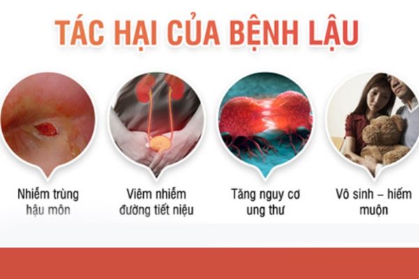 Benh-lau-nu-gioi-3
