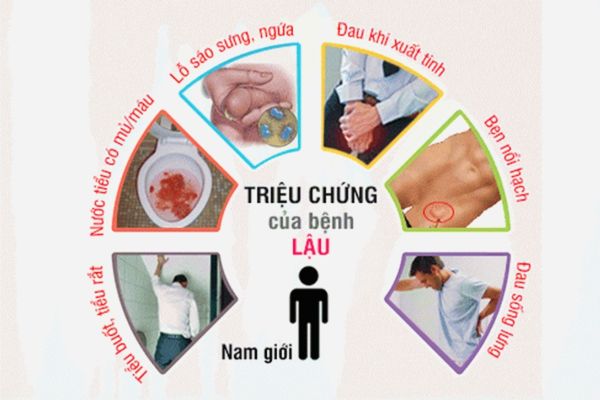 Benh-lau-o-nam-gioi-1