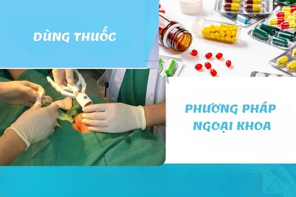 Dieu-tri-hep-bao-quy-dau-1