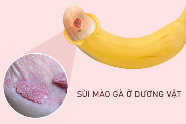 sui-mao-ga-o-duong-vat-1