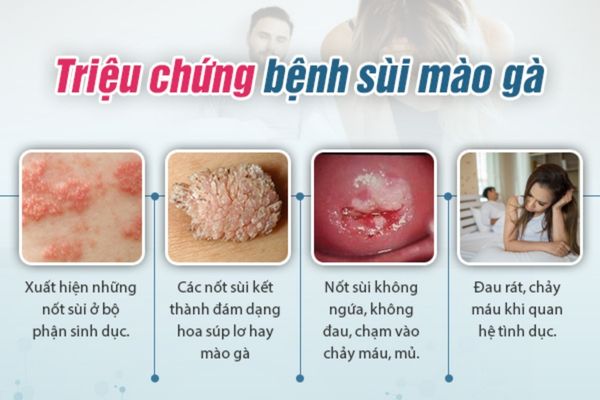 Phong-kham-chua-sui-mao-ga-1