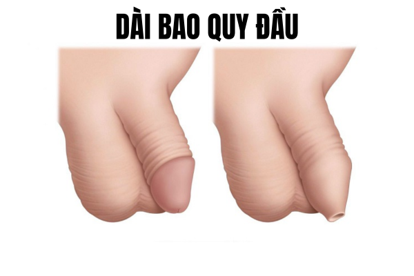 dai-bao-quy-dau-co-nguy-hiem-khong-lam-the-nao-de-khac-phuc-2