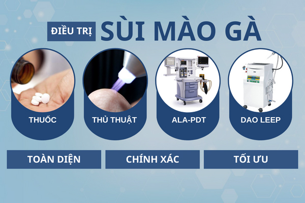 Phương pháp điều trị sùi mào gà hiệu quả tại Phòng Khám Quy Nhơn