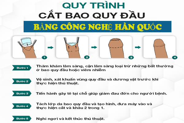 Quy trình cắt bao quy đầu bằng phương pháp tiên tiến không đau tại Quy Nhơn