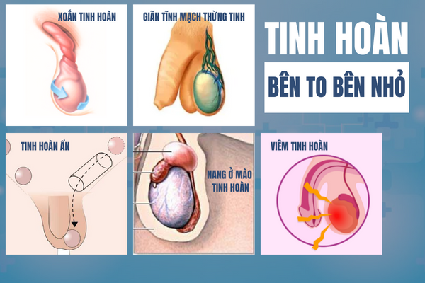 tai-sao-tinh-hoan-ben-to-ben-nho-2