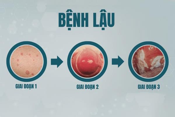 tong-hop-nhung-thong-tin-ve-can-benh-hoa-lieu-4