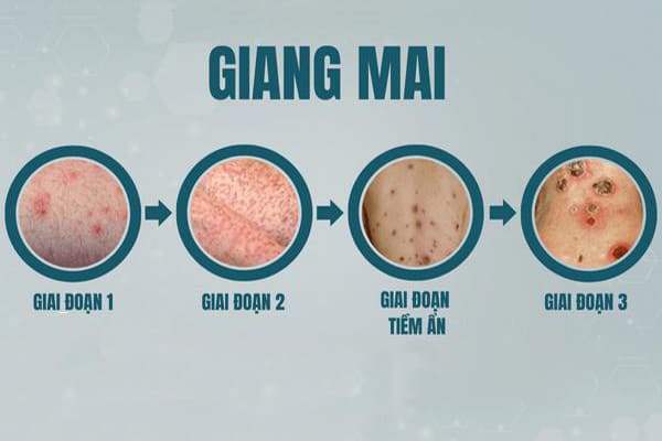 tong-hop-nhung-thong-tin-ve-can-benh-hoa-lieu-5