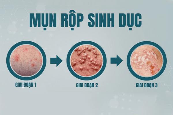 tong-hop-nhung-thong-tin-ve-can-benh-hoa-lieu-6