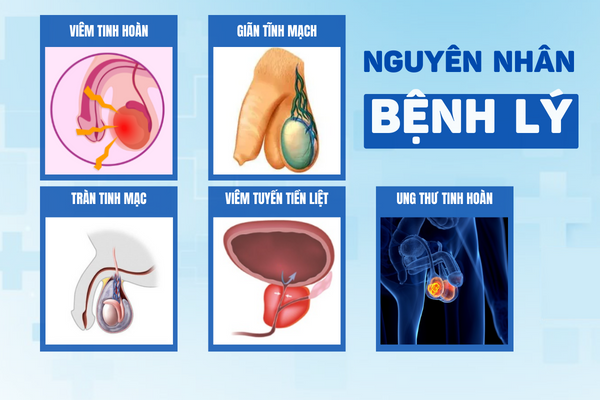 xe-tinh-hoan-nguyen-nhan-va-cach-khac-phuc-1