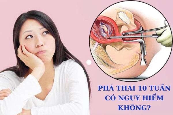 Phá thai 10 tuần tuổi có nguy hiểm không?