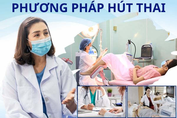 Phương pháp hút thai an toàn